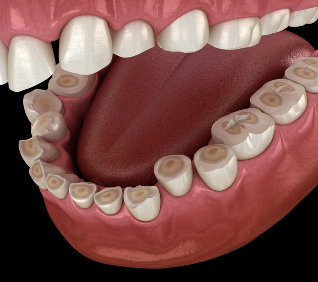 Advanced Diagnosis and Effective Care for Occlusal Disease
