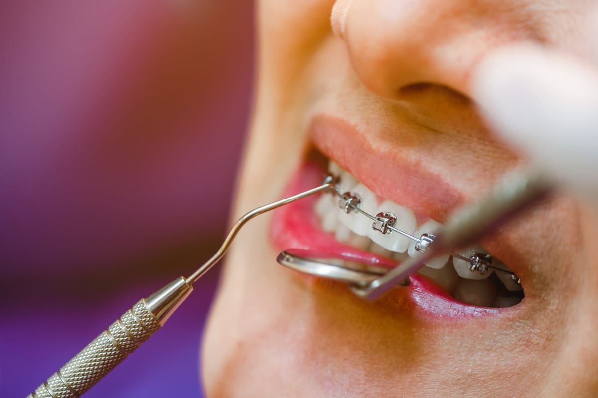 Restorative Dentistry in Richmond