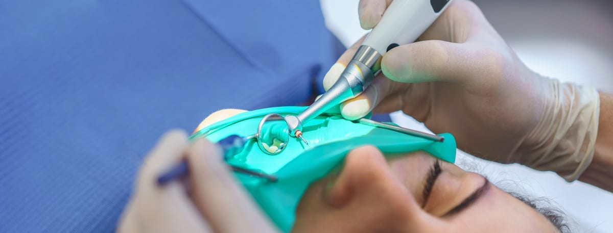 Root Canal Treatment in Richmond
